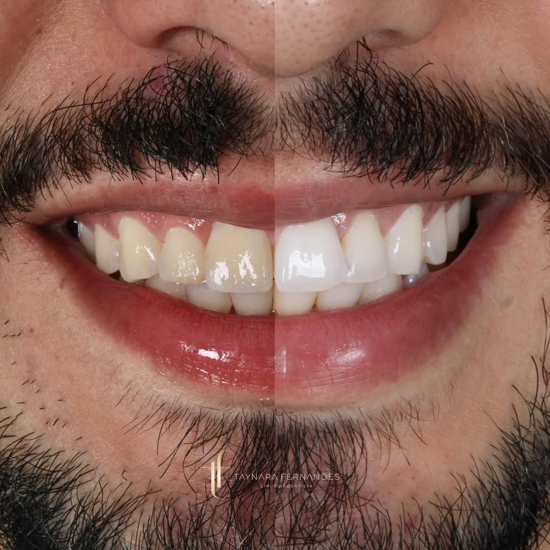 Transformação Estética (antes e depois)